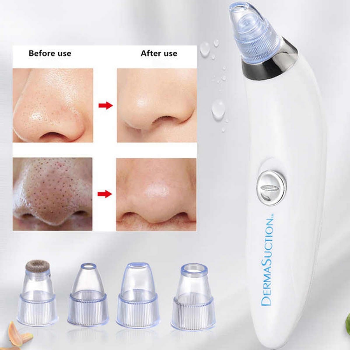 Derma Suction Blackhead Removal Machine 4 In 1 Machine