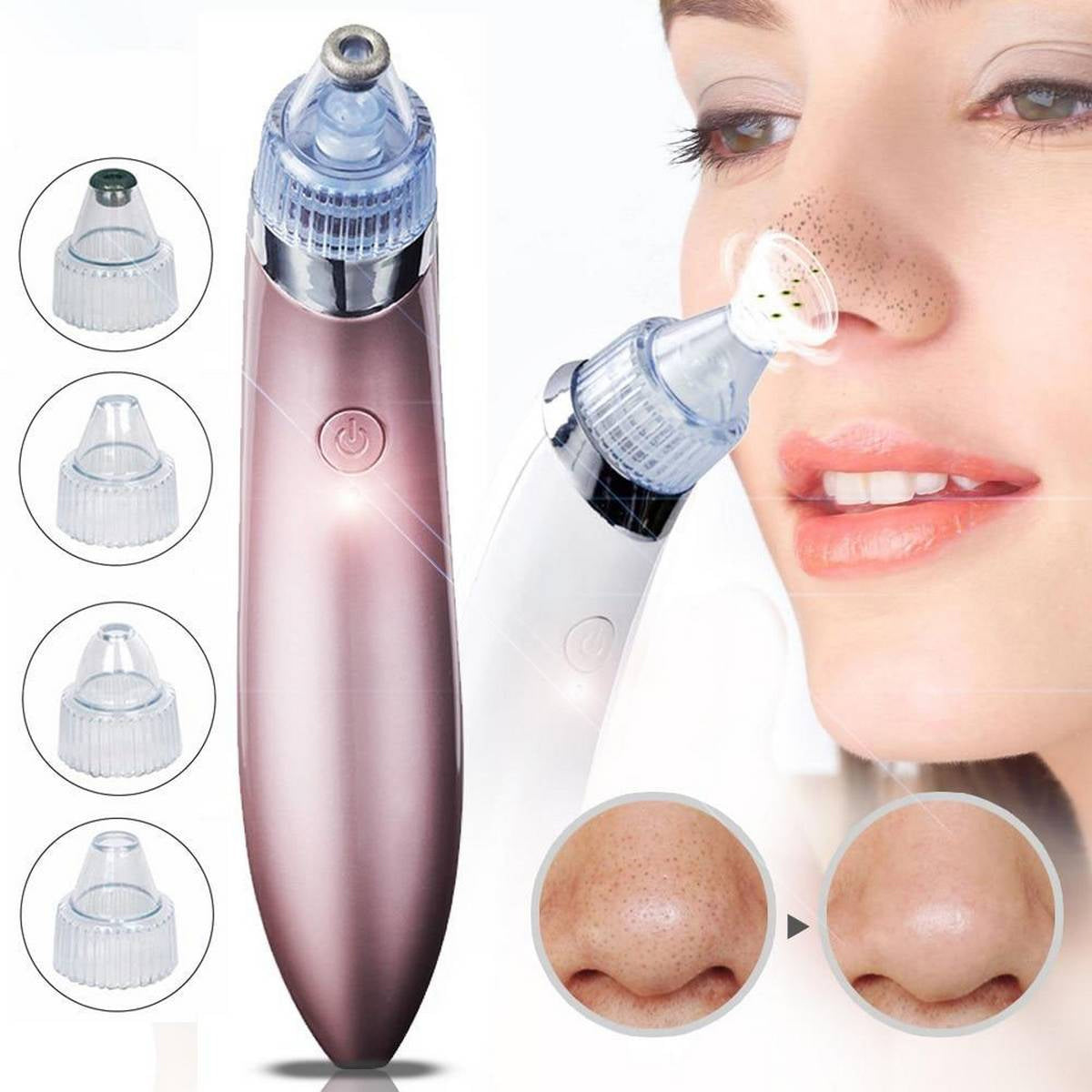 Derma Suction Blackhead Removal Machine 4 In 1 Machine
